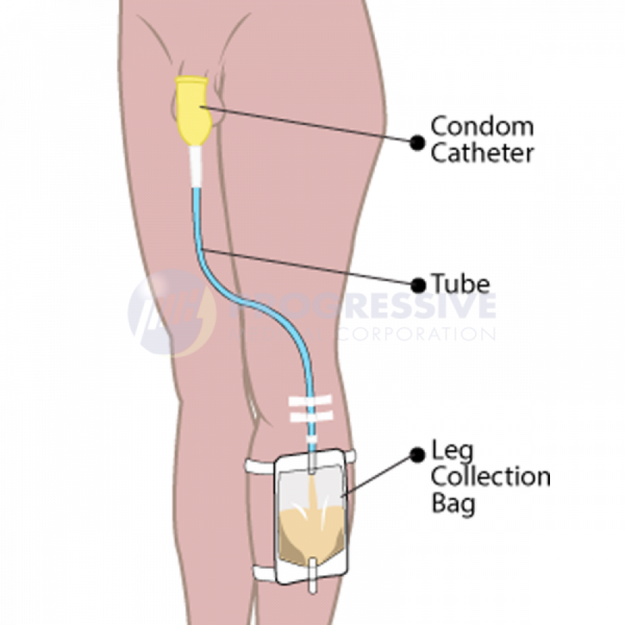 Condom Tube